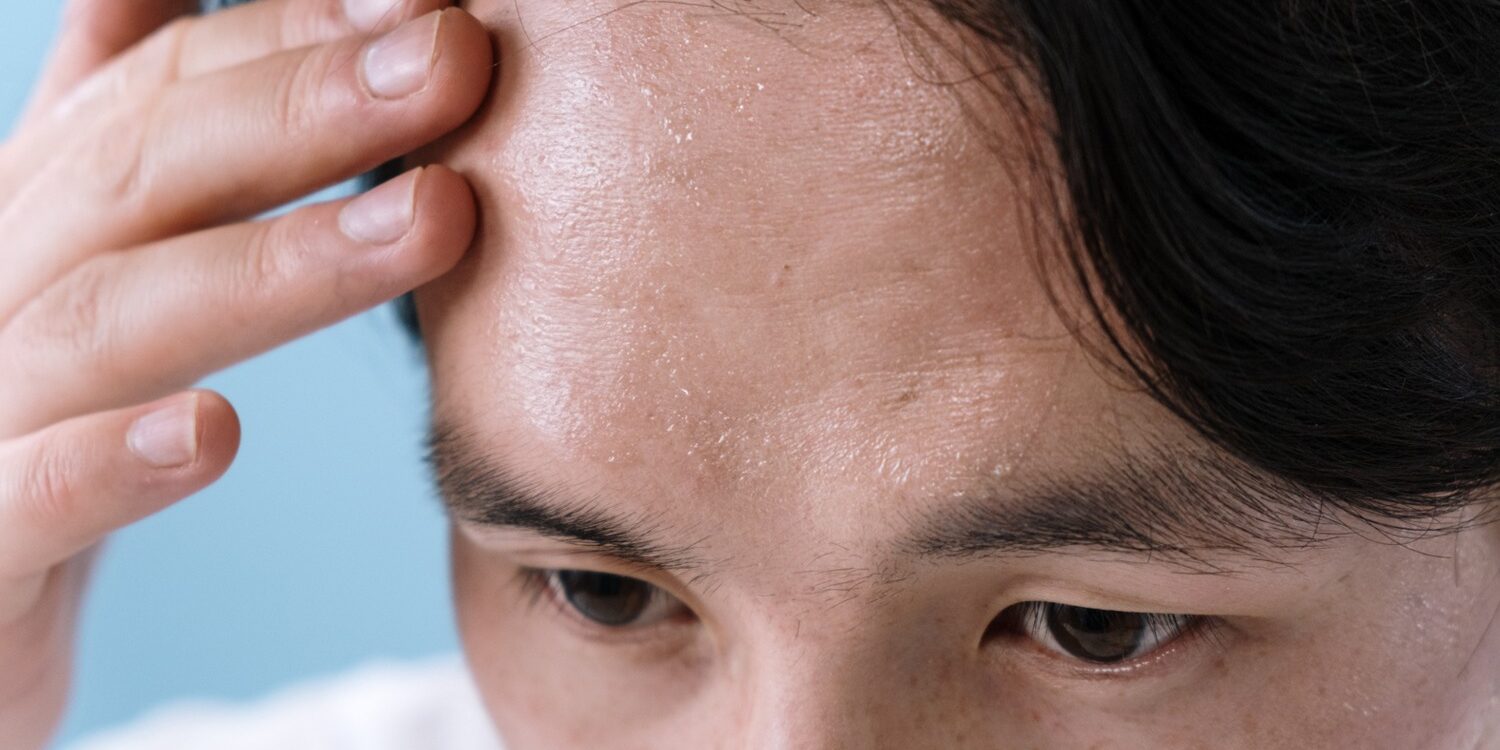 Hiperhidrosis Hiperhidrosis