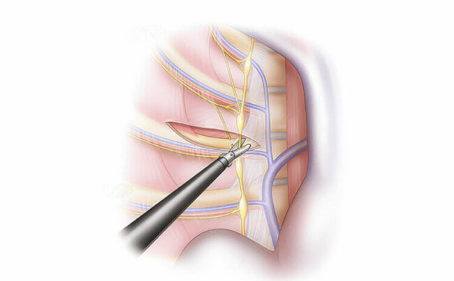 Klipsli-ETS-750×465 Klipsli-ETS-750x465