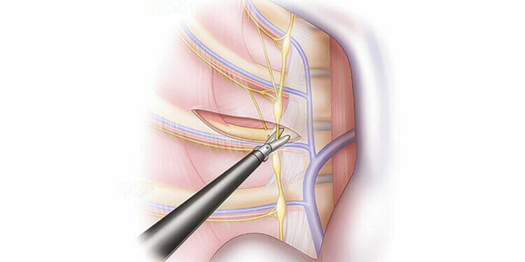 Klipsli-ETS-750×465 Klipsli-ETS-750x465