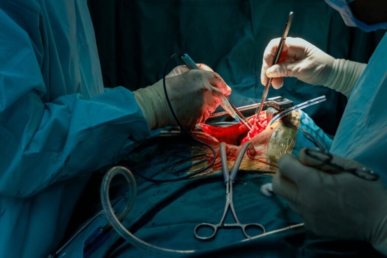 Lung Cancer Treatment